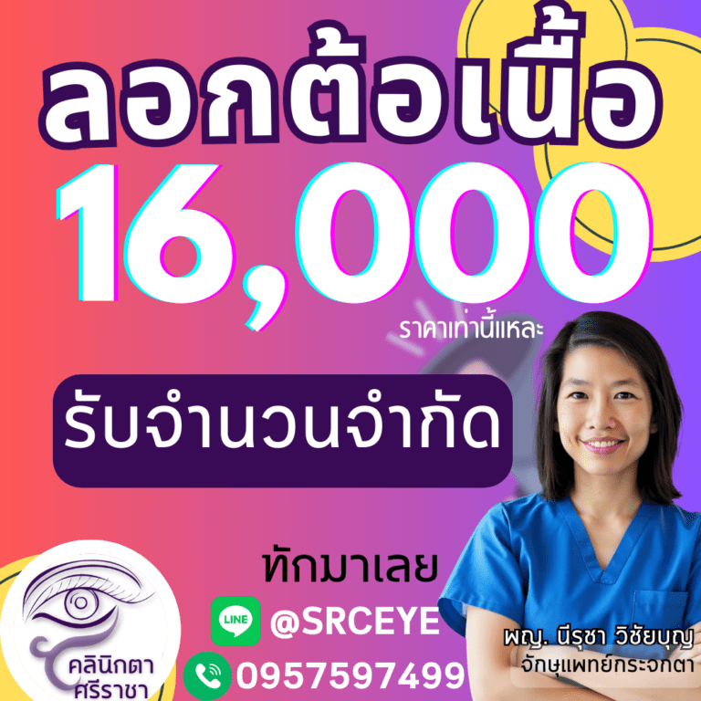 ผ่าตัดต้อเนื้อ 16,000