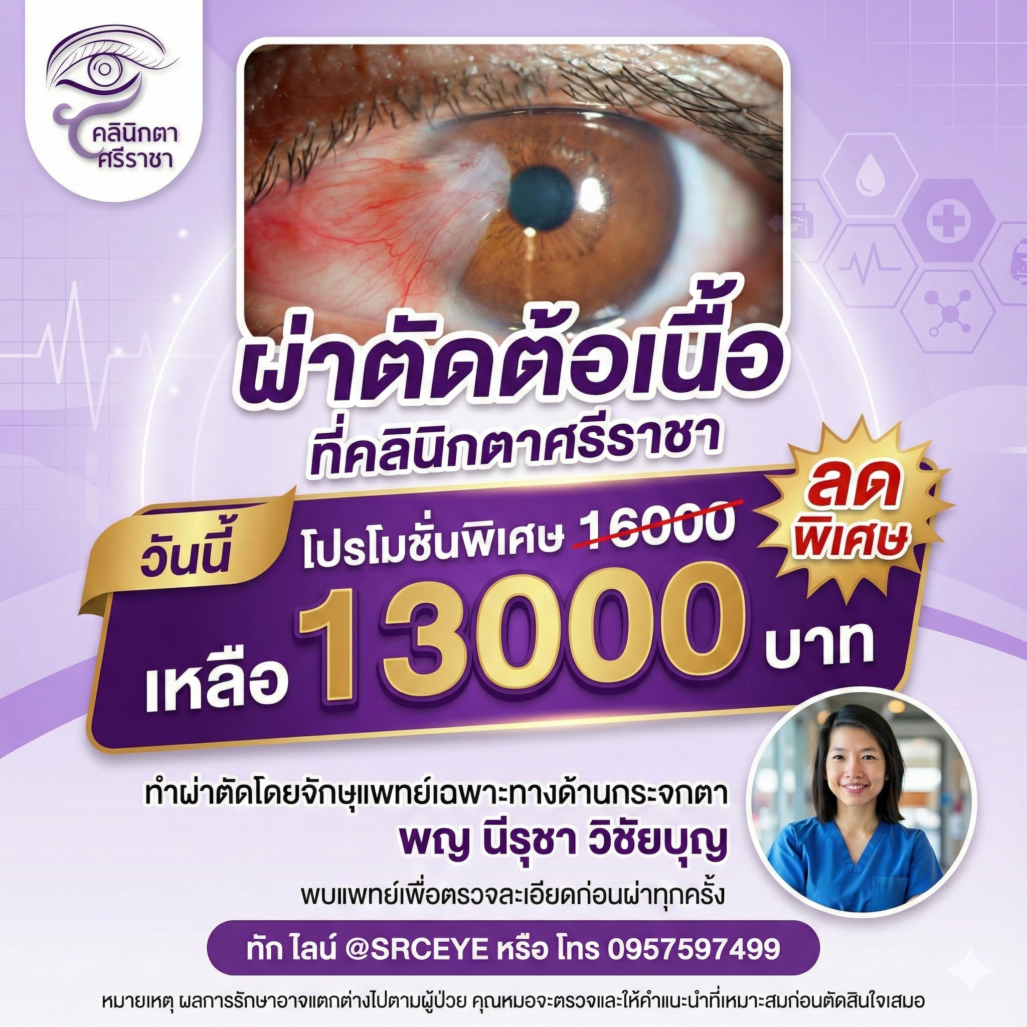 โปรโมชั่นผ่าตัดต้อเนื้อ