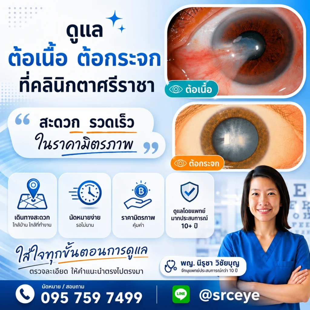ผ่าตัดต้อเนื้อ ผ่าตัดต้อกระจก ที่คลินิกตาศรีราชา